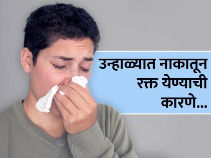 How to stop nose bleeding in summer | उन्हाळ्यात नाकातून येणारं रक्त थांबवण्यासाठी करा हे सोपे घरगुती उपाय!