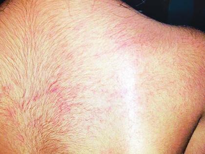 Teacher beats student for not going to shop | अमानुष; दुकानात जाण्यास नकार दिल्याने शिक्षिकेची विद्यार्थिनीस बेदम मारहाण Teacher beats student for not going to shop | अमानुष; दुकानात जाण्यास नकार दिल्याने शिक्षिकेची विद्यार्थिनीस बेदम मारहाण