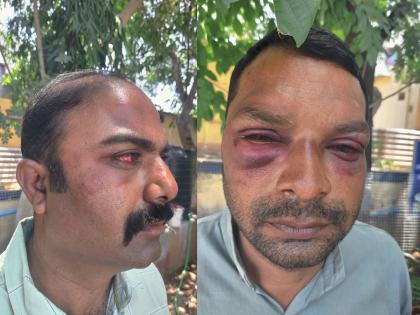 Fatal attack on two policemen over eating in a hotel, incident in Padegaon | हॉटेलमध्ये जेवण्यावरून दोन पोलिसांवर जीवघेणा हल्ला, पडेगावातील घटना