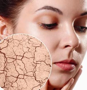 थंडीमुळे त्वचा कोरडी, भुरकट दिसतेय? रात्री झोपताना किचनमधले ४ पदार्थ लावा- त्वचा मऊ, चमकदार होईल