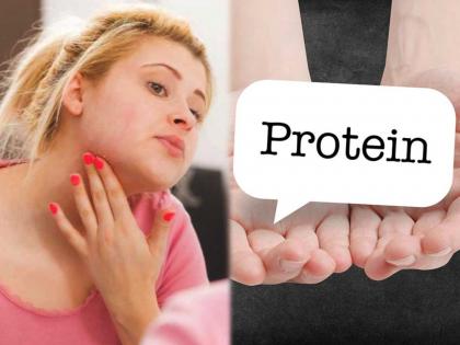 Health Tips : Symptoms or warning sign of protein deficiency | Health Tips : शरीरात प्रोटीनची कमतरता झाल्यास दिसतात ही ५ गंभीर लक्षणं, दुर्लक्ष कराल तर पडेल महागात!