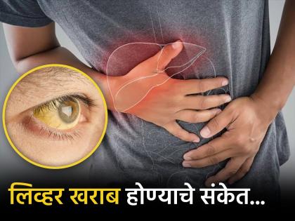 Liver disease red flag symptoms on your face and skin | चेहऱ्यावर दिसत असतील ही लक्षणं तर समजा खराब होत आहे लिव्हर, लगेच करा हे काम