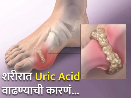 Purine and fructose rich foods which increase high uric acid to avoid gout and kidney stones | या काही सवयींमुळे शरीरात वाढतं Uric Acid, किडनीमध्ये जमा होतात विषारी पदार्थ