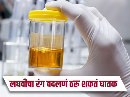 Urine Color : Causes of yellow urine in summer season | उन्हाळ्यात लघवीचा रंग जास्त पिवळा दिसतो का? 'या' असू शकतात समस्या...