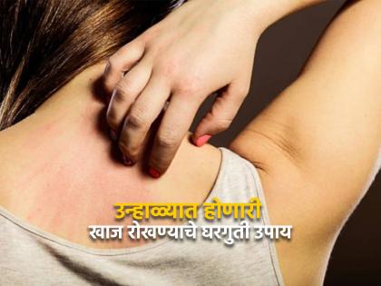 Home remedies to get rid of itching during summers | उन्हाळ्यात त्वचेवर येणारी खाज रोखण्याचे खास अन् सोपे घरगुती उपाय