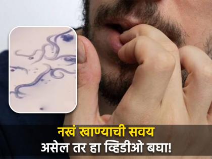 You will never bite nails with teeth after watch this video | तुम्हालाही नखं खाण्याची सवय आहे का? हा व्हिडीओ पाहून सुटेल तुमची सवय