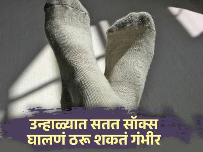 Wearing socks in summer may cause fungal infection you should know this | उन्हाळ्यात दिवसभर सतत सॉक्स घालून राहिल्याने होतात 'या' गंभीर समस्या, वेळीच व्हा सावध!