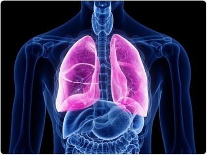 Lung fibrosis in 134 patients with corona; 13.72% of patients are health care workers | कोरोनाच्या १३४ रुग्णांना ‘लंग फायब्रोसिस’; १३.७२ टक्के रुग्ण हे ‘हेल्थ केअर वर्कर’