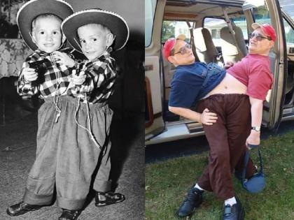 SEE PICS! World's longest-surviving conjoined twins die together at the age of 68