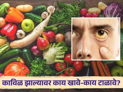 Jaundice symptoms and causes, know what you can eat to get better soon! | काविळ झाल्याची लक्षणे आणि कारणे, जाणून घ्या काय खाऊन होऊन शकता लवकर बरे!