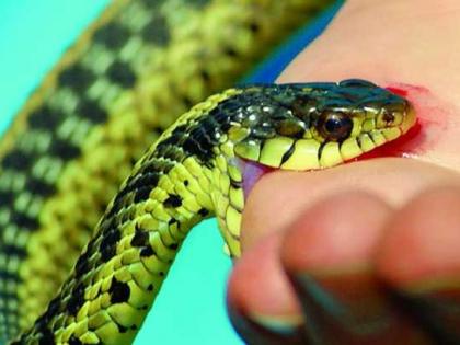 64 incidents of snake bites in Solapur; Know ... the next health problem after a snake bite | साप चावल्याच्या सोलापुरात ६४ घटना; जाणून घ्या... सर्पदंशानंतर पुढच्या आरोग्यविषयक समस्या