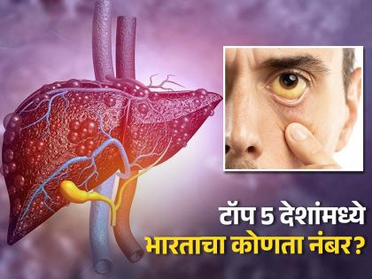 India in top five countries with highest hepatitis cases WHO | लिव्हरच्या 'या' गंभीर आजाराचे रोज हजारो लोक होत आहेत शिकार, जाणून घ्या कारणे...