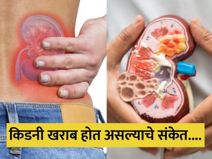 Chronic kidney disease warning signs you may pay attention | शरीरात हे संकेत दिसताच समजा किडनी होत आहे खराब, कसा कराल बचाव?