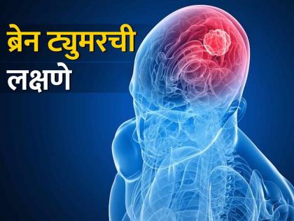 Early symptoms of brain tumor, for go to the doctor immediately | ब्रेन ट्युमरची सुरुवातीची लक्षणे, दिसताच डॉक्टरांना दाखवले पाहिजे