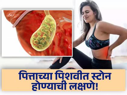 Gallbladder stone : Early sings and symptoms of gallbladder stone and best treatment for gallbladder stone | केवळ किडनीच नाहीतर पित्ताशयातही होतात स्टोन, जाणून घ्या लक्षणे!