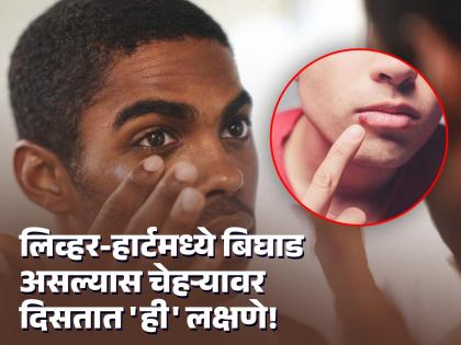 Your face is giving signs of many serious diseases, how do you know what is the problem? | तुमचा चेहरा देत असतो अनेक गंभीर आजारांचे संकेत, कशी जाणून घ्याल काय समस्या आहे?