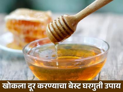 Honey is the best treatment for Cough, Know how to use it | मधापासून घरीच तयार करा खोकल्याचं सिरप, कोरडा खोकला लगेच होईल गायब