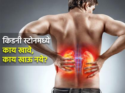 What to eat and what not in kidney stone problem | किडनी स्टोन असेल तर काय खावे आणि काय खाऊ नये?