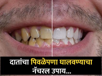 Use mulethi powder and curd for teeth whitening home remedies | दात पिवळे असल्याने चारचौघात हसताही येत नाही? हा सोपा उपाय करून दात करा चमकदार!