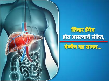 Warning signs and symptoms of liver damage know causes | 'या' संकेतांवरून समजतं लिव्हरवर पडत आहे जास्त दबाव, वेळीच व्हा सावध!