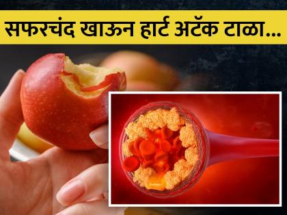 Apple can reduce bad cholesterol naturally know other health benefits of eating apple daily | शरीरातील बॅड कोलेस्ट्रॉल झटक्यात नष्ट करतं सफरचंद, जाणून घ्या इतरही फायदे...