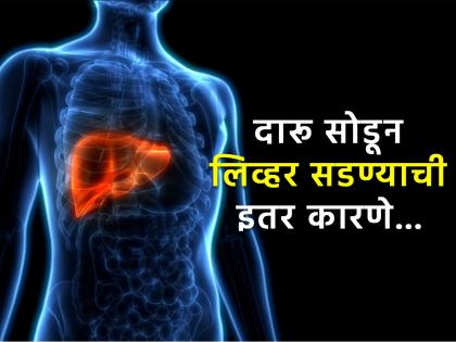 Liver problems common health mistakes who can damage your liver | दारूच नाहीतर या गोष्टींमुळेही सडतं लिव्हर, मेडिकल एक्सपर्टने दिला इशारा