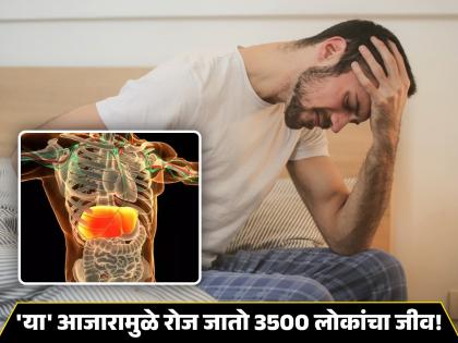 What is viral hepatitis, rise in global deaths know the symptoms | फारच घातक आहे वेगाने वाढणारा हा आजार, वेळीच समजला नाही तर जाऊ शकतो जीव!