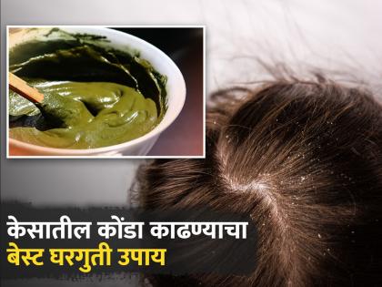 What to mix in henna to get rid of dandruff | केसांमधील कोंडा दूर करण्यासाठी मेहंदीचा असा करा वापर, मुलायम-चमकदार होतील केस!