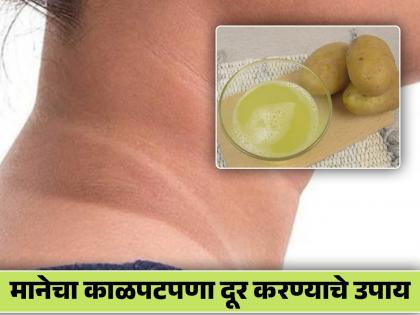 How to get rid of dark neck, you should know this | या गंभीर आजारामुळेही काळी होते मान, जाणून घ्या काळपटपणा दूर करण्याचे उपाय!