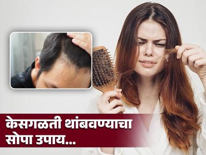 How to stop hail fall and how to grow hair naturally | केस गळतात, कोंडा झालाय, वाढत नाहीत...जास्तीत जास्त लोक 'या' गोष्टीकडे करतात दुर्लक्ष!