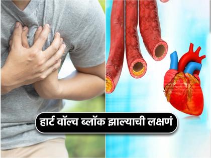 Cardiologist told heart valvular disease symptoms causes risk factors treatment and prevention tips | नेहमी थकवा असतो किंवा श्वास कमी झालाय? या लक्षणांवरून जाणून घ्या हार्ट वॉल्व झाले आहेत ब्लॉक