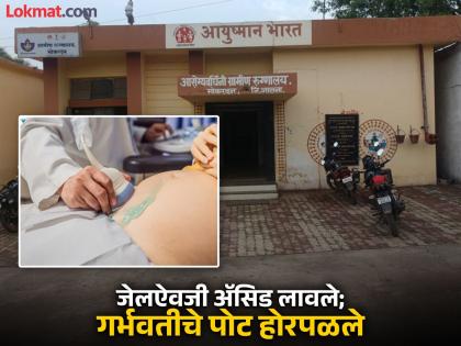 Shocking! Acid was applied to pregnant woman's stomach instead of gel during sonography, child born under difficult circumstances | जेलऐवजी ॲसिड लावल्याने गर्भवतीचे पोट होरपळले; कठीण परिस्थितीत मुलाला दिला जन्म Shocking! Acid was applied to pregnant woman's stomach instead of gel during sonography, child born under difficult circumstances | जेलऐवजी ॲसिड लावल्याने गर्भवतीचे पोट होरपळले; कठीण परिस्थितीत मुलाला दिला जन्म