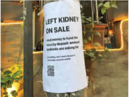 'Rent to be paid... Does anyone buy a kidney?' benguluru youth ad on tree social viral | ‘घरभाडे द्यायचेय... कुणी किडनी विकत घेता का?’