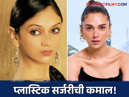 Aditi Rao Hydari also undergo plastic surgery ? Fans were shocked to see the old photo! | आदिती राव हैदरीनेही केलीये प्लास्टिक सर्जरी? जुना फोटो पाहून चाहते शॉक!