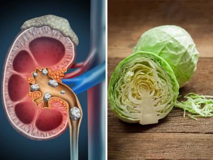 Superfoods for kidney : Which foods clean and repair kidney | किडनीचे फिल्टर खराब झाले की रक्त होतं विषारी, या उपायांनी ठेवा सुरक्षित!