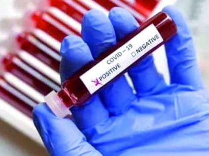 CoronaVirus in Nagpur: 419 new positive, 21 deaths | CoronaVirus in Nagpur : ४१९ नवे पॉझिटिव्ह, २१ रुणांचा मृत्यू