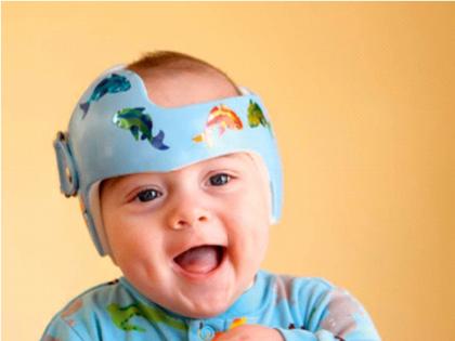 Helmets are also worn by infants in China! | चीनमध्ये तान्ह्या बाळांनाही घातलं जातंय हेल्मेट!