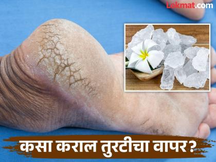 Alum is the cure for many skin problems you will get amazing glow | हिवाळ्यात तुरटीचा 'असा' करा वापर, चेहरा चमकदार होण्यासोबतच टाचांच्या भेगाही होतील दूर!