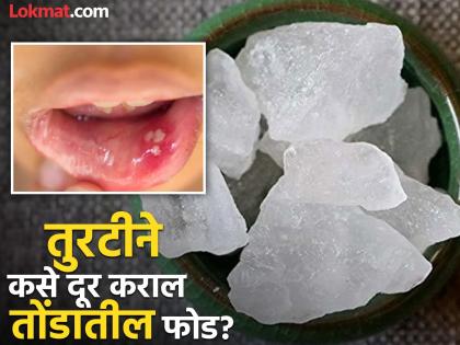 How to use fitkari to get rid of mouth ulcer gum problem | तोंडातील फोड आणि हिरड्यांची समस्या झटक्यात होईल दूर, 2 रूपयांच्या तुरटीचा 'असा' करा वापर!