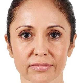 चेहऱ्यावर सुरकुत्या इतक्या की ऐन पंचविशीत चेहऱ्यावर चाळिशी दिसते? तुरटी ‘अशी’ लावा, तारुण्य येईल परत