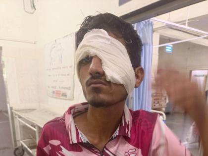 Passenger boy injured in stone pelting on local, hit eye | लोकल वर दगडफेकीत प्रवाशी मुलगा जखमी, डोळ्याला मार