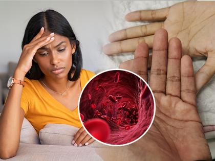 Anemia is often pointed at women; But... | अनेकदा ॲनिमिया म्हटले की महिलांकडे बोट दाखवले जाते; पण...