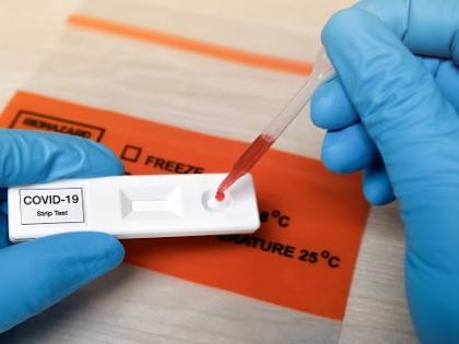 Reports of patients with symptoms being negative; Now test the antigen test kit | लक्षणे असलेल्या रूग्णांचे अहवाल निगेटिव्ह; आता ॲंटीजेन टेस्टच्या किटचीच टेस्ट करा