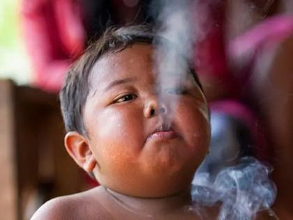 Ardi Rizal chain Smoker: two-year-old boy to smoke 40 cigarettes a day; Addiction quit, now it look like this | Ardi Rizal: बाबो! दोन वर्षांचा मुलगा दिवसाला ४० सिगारेट ओढायचा; व्यसन सुटले, आता दिसतो असा...