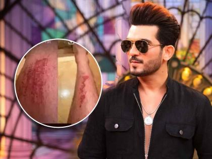 tv actor arjun bijlani met with an accident in goa suffers leg injury shared photo | टीव्ही अभिनेता अर्जुन बिजलानीचा अपघात, पायांना गंभीर दुखापत, फोटो पाहून चाहते चिंतेत