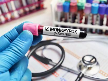 Preparing to make a vaccine against 'Monkeypox'; Halfkin Initiative of Maharashtra Govt | 'मंकीपॉक्स'वरील लस बनवण्याची तयारी; महाराष्ट्र शासनाच्या हाफकिनचा पुढाकार