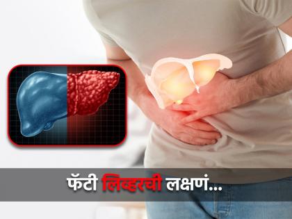 Early symptom of fatty liver which can make some people happy which should not be ignored | Fatty Liver च्या या लक्षणाने आनंद मिळू शकतो, पण इथूनच सुरू होतो धोका!