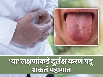 Liver disease: Fissured and atrophic tongue could be signs of advanced disease | जिभेवर दिसतात लिव्हर डॅमेजची ही 4 लक्षणं, वेळीच व्हा सावध!