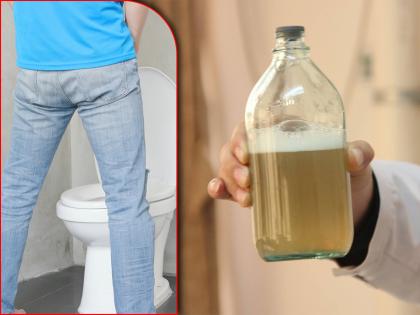 Foamy urine is the symptom of protein in urine problem that can indicate kidney and heart disease | लघवीमध्ये फेस येत असेल तर वेळीच व्हा सावध, या लक्षणांकडे करू नका दुर्लक्ष