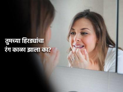 Causes of black tooth and gum, Know the reson | हिरड्यांचा रंग लाल आहे की काळा? जाणून घ्या याची कारणे....